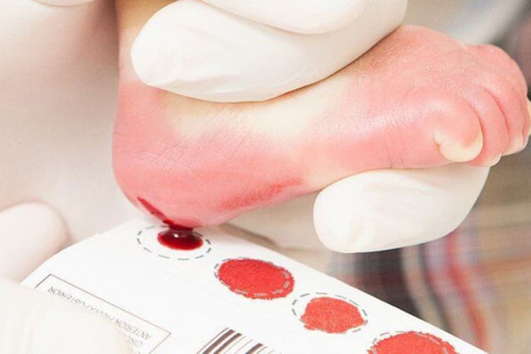 Qual a importância do teste do pezinho no bebê?