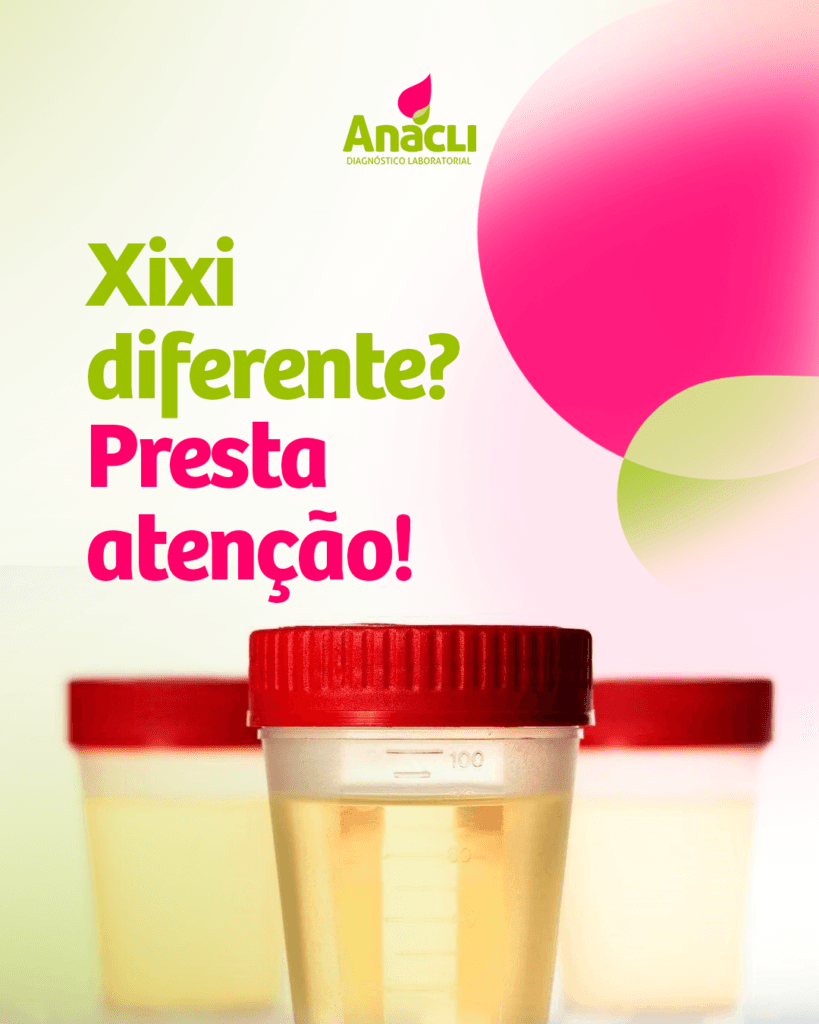 Seu xixi mudou de cor? Veja o que isso pode indicar!